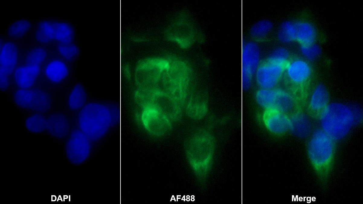 Monoclonal Antibody to Endoglin (ENG)