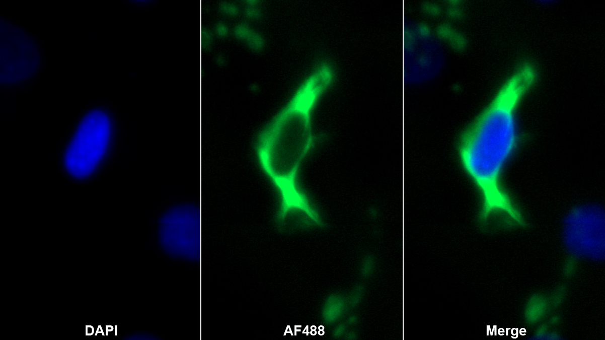 Monoclonal Antibody to Protein Zero, Myelin (MPZ)