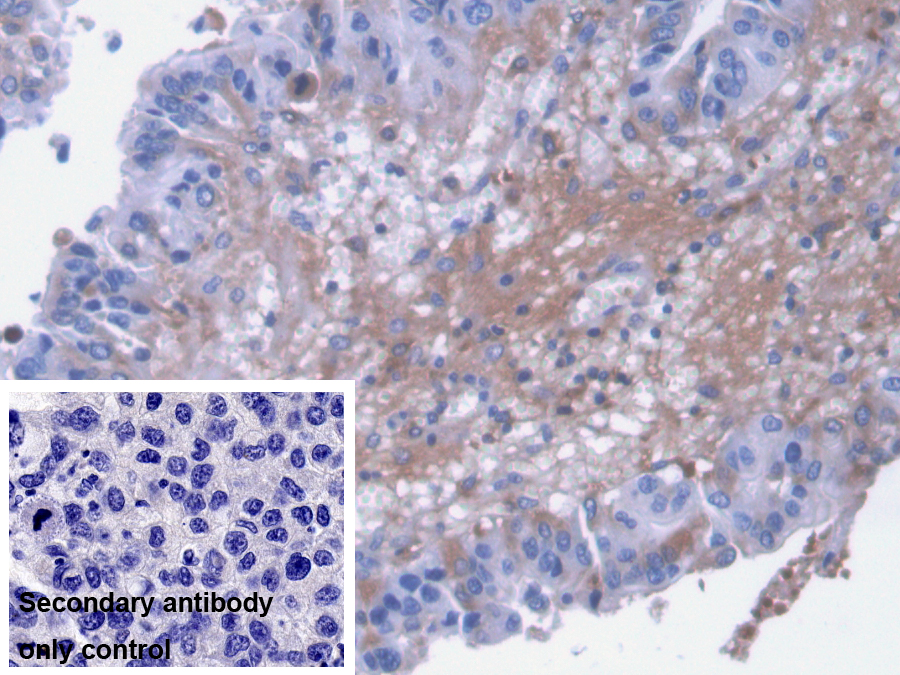 Monoclonal Antibody to Alpha-2-Macroglobulin (a2M)