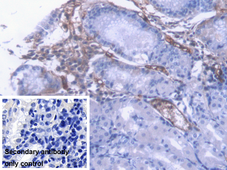 Monoclonal Antibody to Alpha-2-Macroglobulin (a2M)