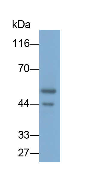 Monoclonal Antibody to Angiopoietin Like Protein 4 (ANGPTL4)