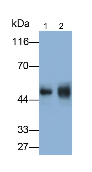 Monoclonal Antibody to Angiopoietin Like Protein 4 (ANGPTL4)