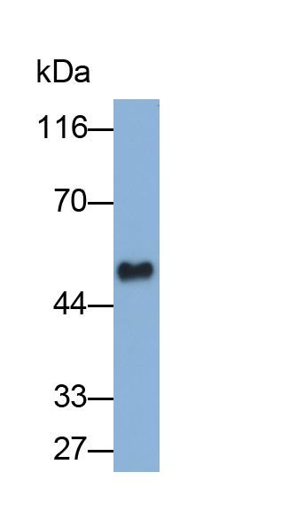 Monoclonal Antibody to Angiopoietin Like Protein 4 (ANGPTL4)