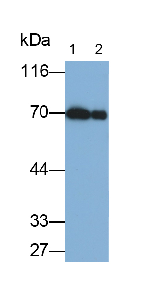 Monoclonal Antibody to Albumin (ALB)