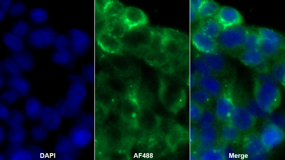 Monoclonal Antibody to Albumin (ALB)