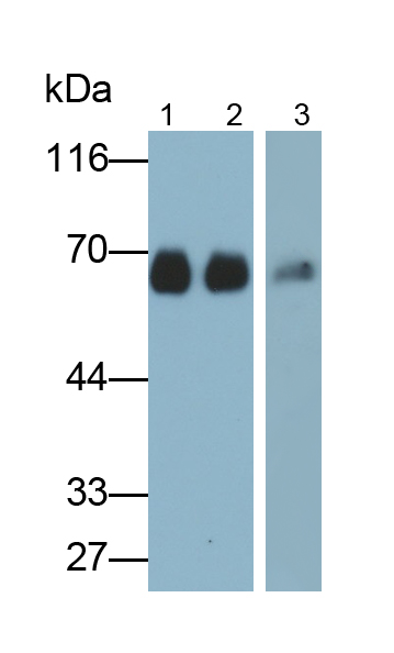 Monoclonal Antibody to Albumin (ALB)