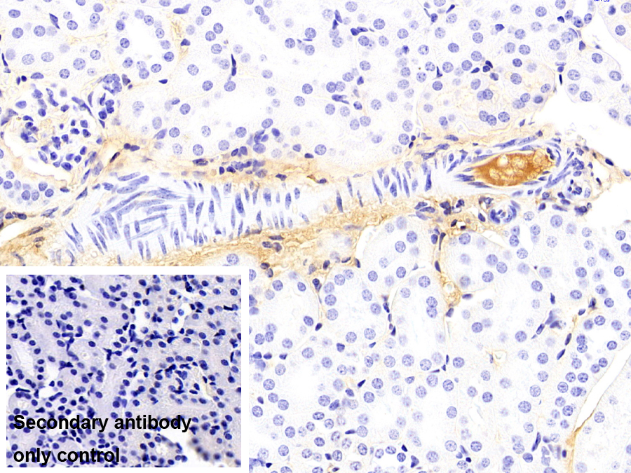 Monoclonal Antibody to Albumin (ALB)