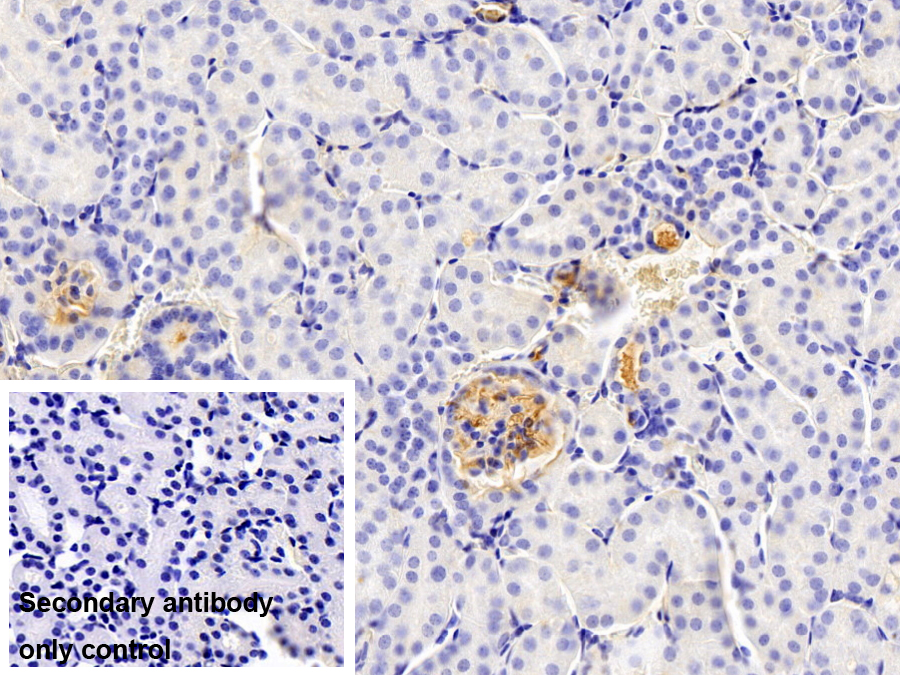 Monoclonal Antibody to Albumin (ALB)