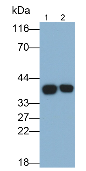 Monoclonal Antibody to Surfactant Associated Protein D (SPD)