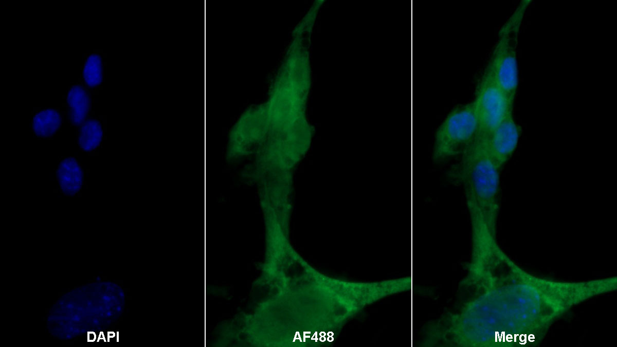 Monoclonal Antibody to Apoptotic Peptidase Activating Factor 1 (APAF1)