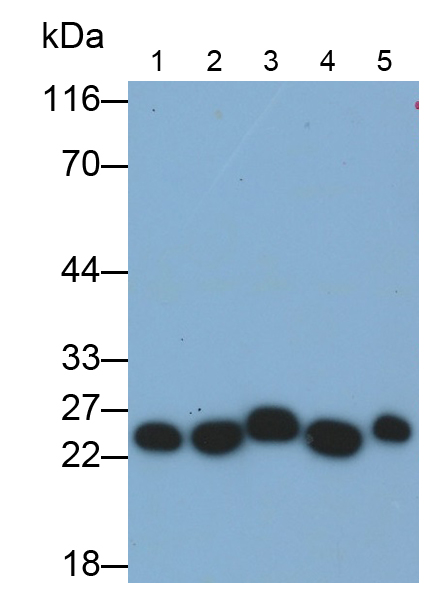 Monoclonal Antibody to Glutathione S Transferase Pi (GSTp)