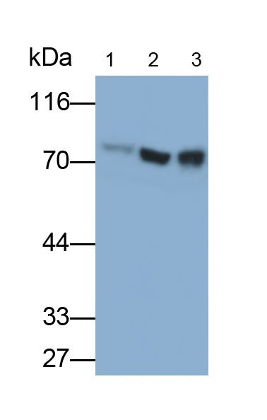 Monoclonal Antibody to Alkaline Phosphatase, Tissue-nonspecific (ALPL)