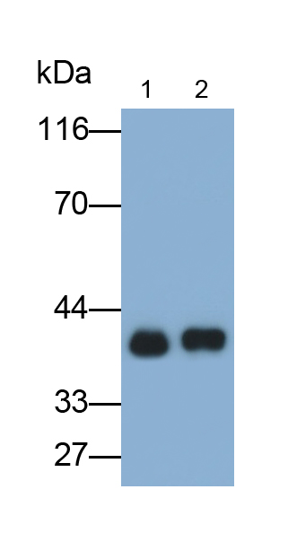 Monoclonal Antibody to Arginase (ARG)