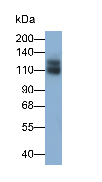 Monoclonal Antibody to Sialic Acid Binding Ig Like Lectin 2 (CD22)