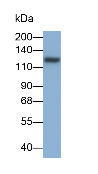 Monoclonal Antibody to Sialic Acid Binding Ig Like Lectin 2 (CD22)