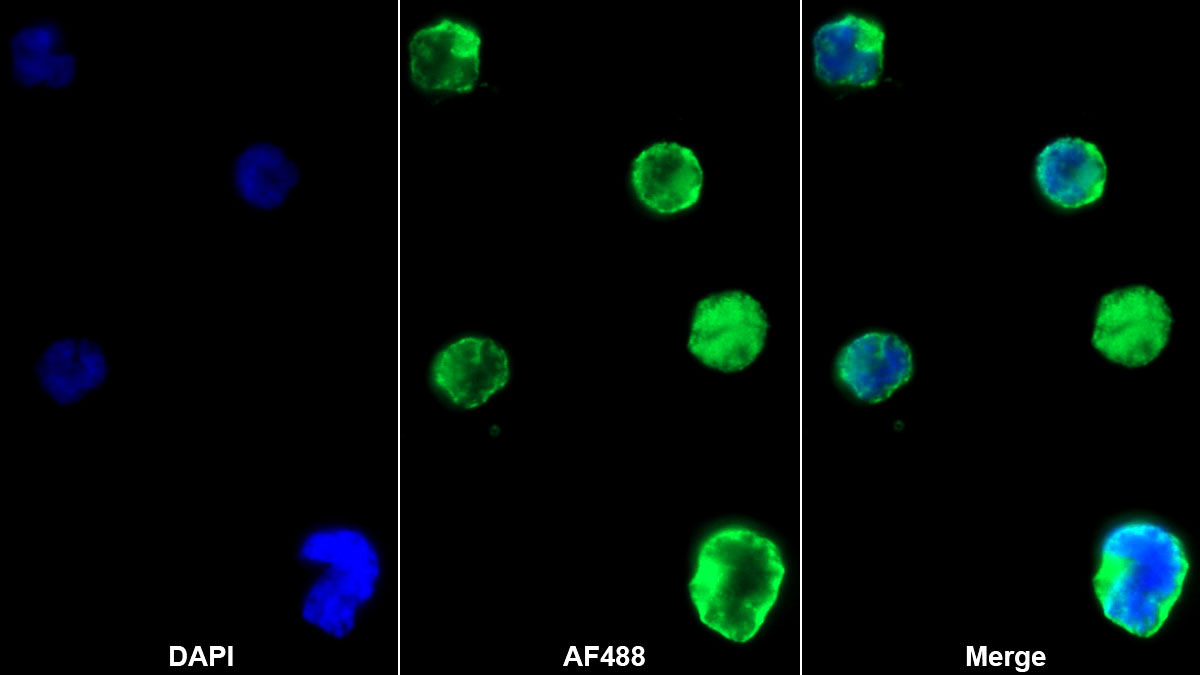 Monoclonal Antibody to Cluster Of Differentiation 4 (CD4)