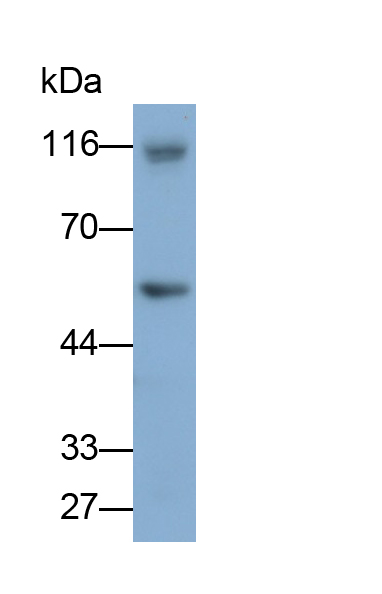 Monoclonal Antibody to Cluster Of Differentiation 4 (CD4)