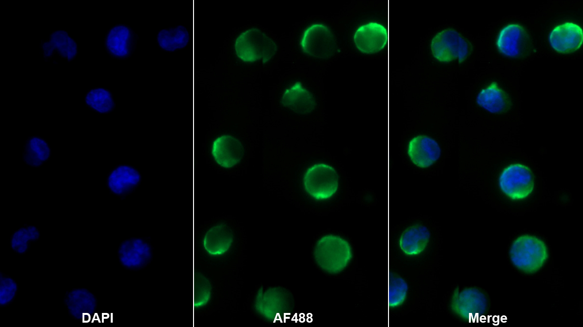 Monoclonal Antibody to Cluster Of Differentiation 1a (CD1a)