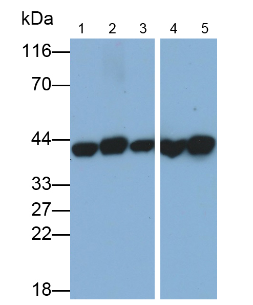 Monoclonal Antibody to Aspartate Aminotransferase (AST)