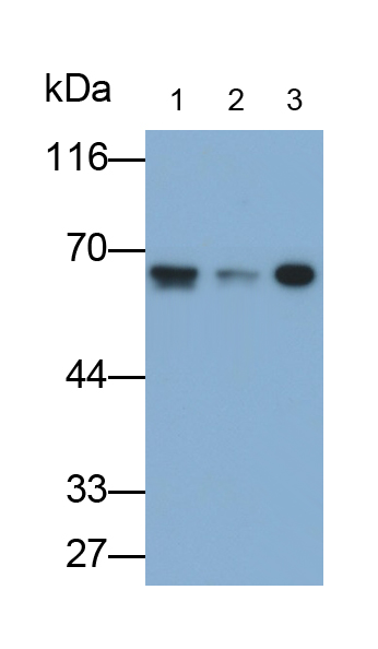 Monoclonal Antibody to Alkaline Phosphatase, Placental (ALPP)