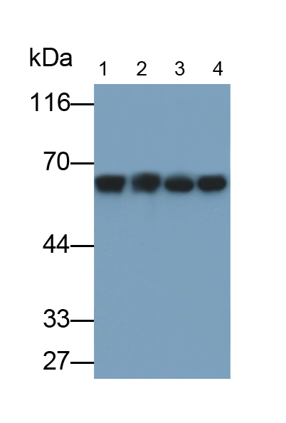 Monoclonal Antibody to Alkaline Phosphatase, Placental (ALPP)