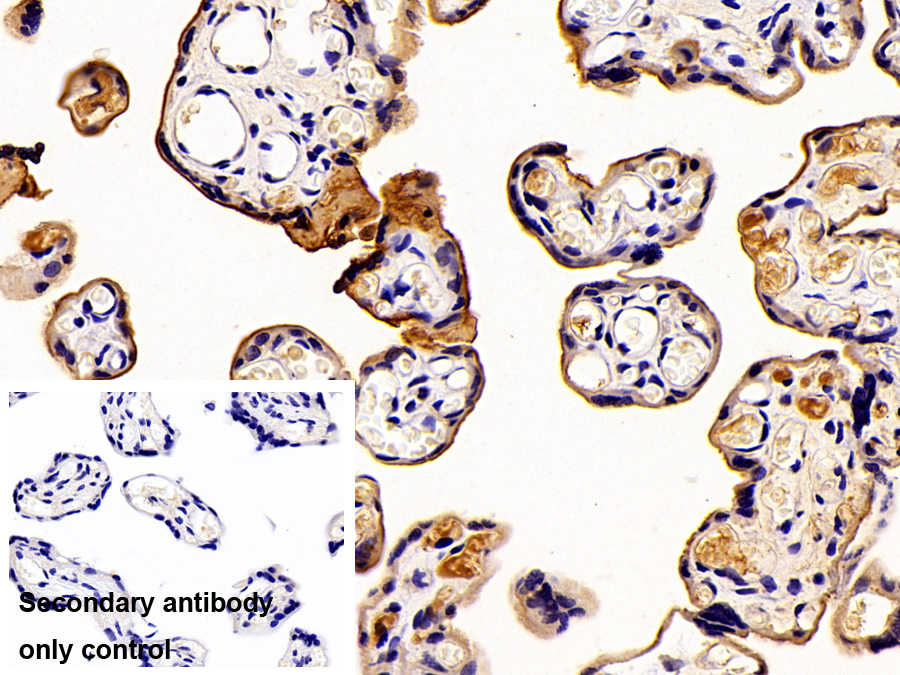 Monoclonal Antibody to Alkaline Phosphatase, Placental (ALPP)