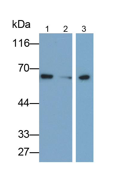 Monoclonal Antibody to Alkaline Phosphatase, Placental (ALPP)