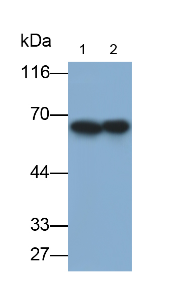 Monoclonal Antibody to Alkaline Phosphatase, Placental (ALPP)