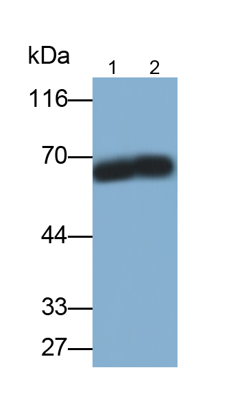 Monoclonal Antibody to Alkaline Phosphatase, Placental (ALPP)