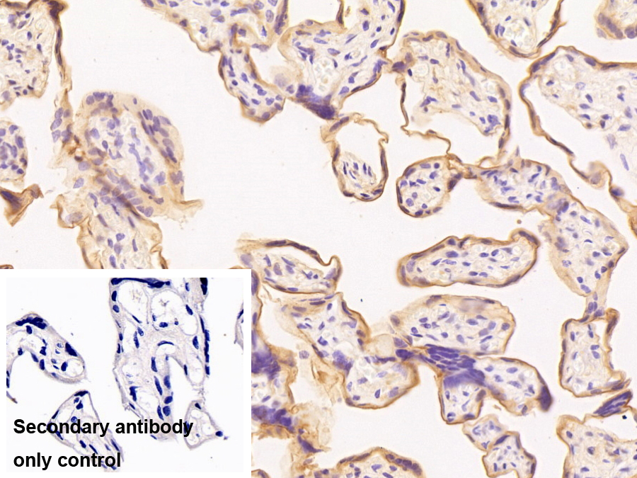 Monoclonal Antibody to Alkaline Phosphatase, Placental (ALPP)