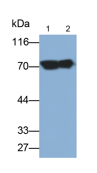 Monoclonal Antibody to Alkaline Phosphatase, Placental (ALPP)