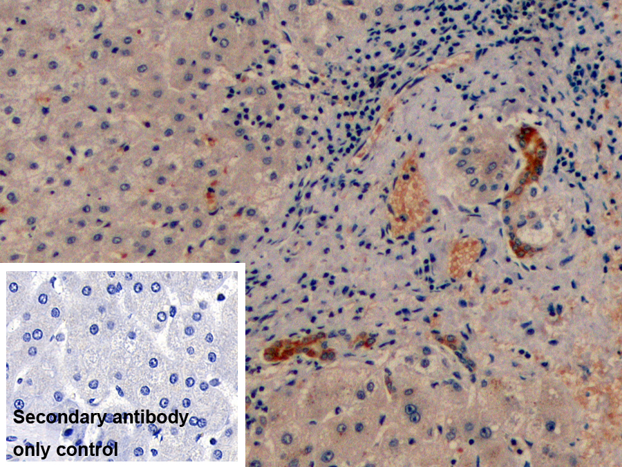 Monoclonal Antibody to Cytokeratin 19 (CK19)