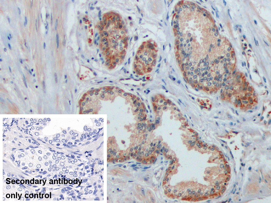 Monoclonal Antibody to Cytokeratin 19 (CK19)