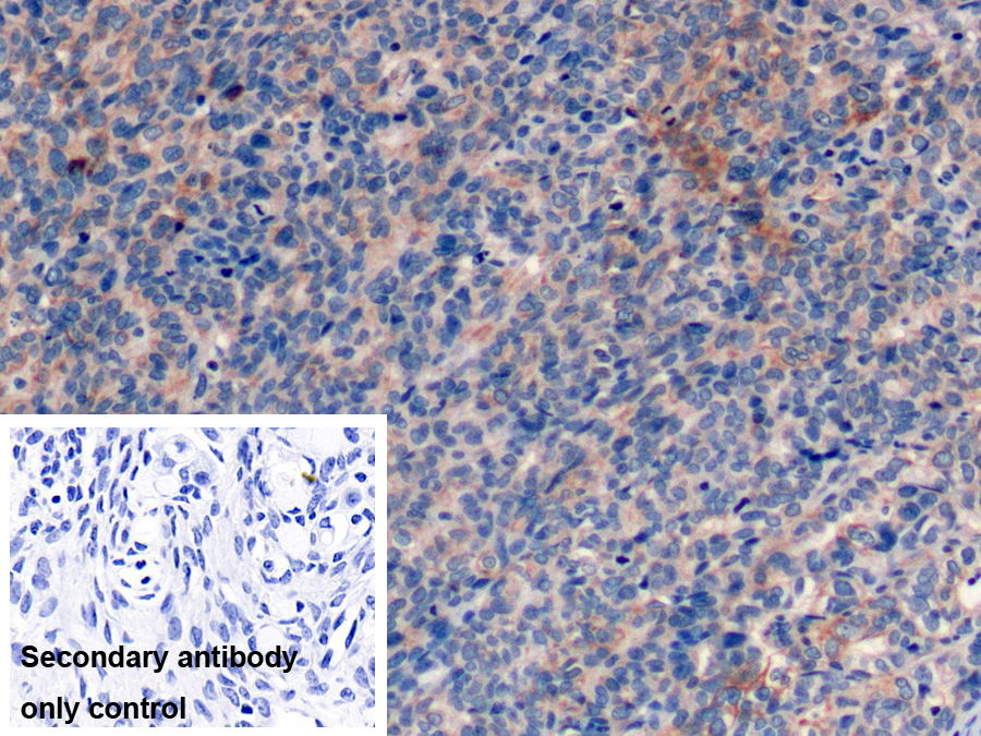 Monoclonal Antibody to Cytokeratin 19 (CK19)