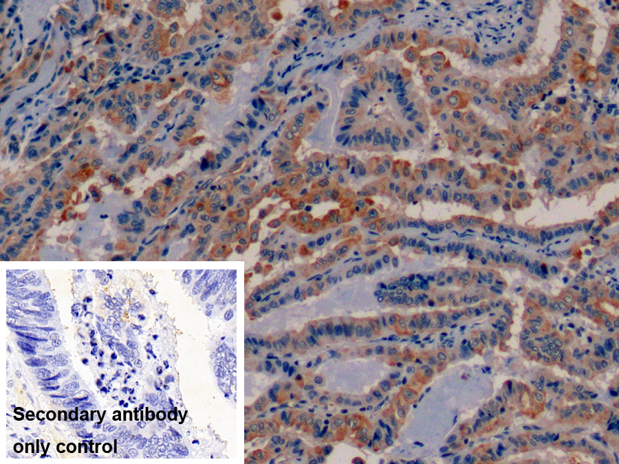 Monoclonal Antibody to Cytokeratin 19 (CK19)