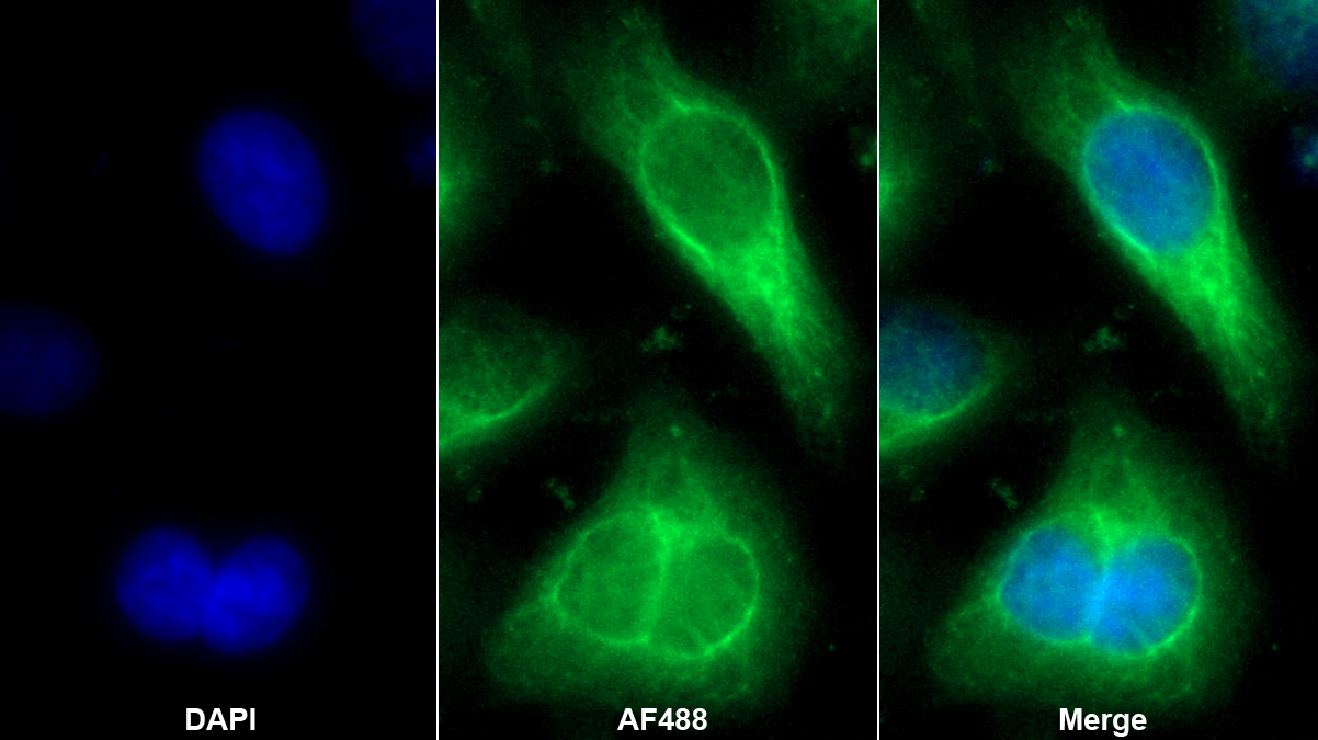 Monoclonal Antibody to Cytokeratin 19 (CK19)