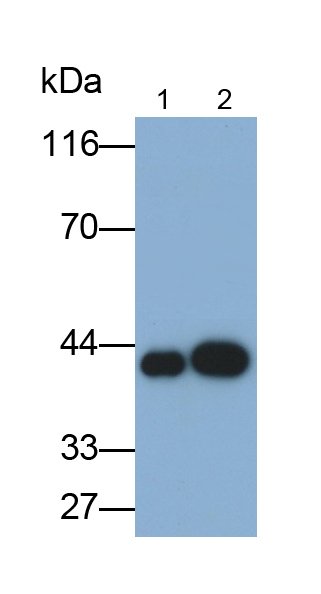 Monoclonal Antibody to Cytokeratin 19 (CK19)