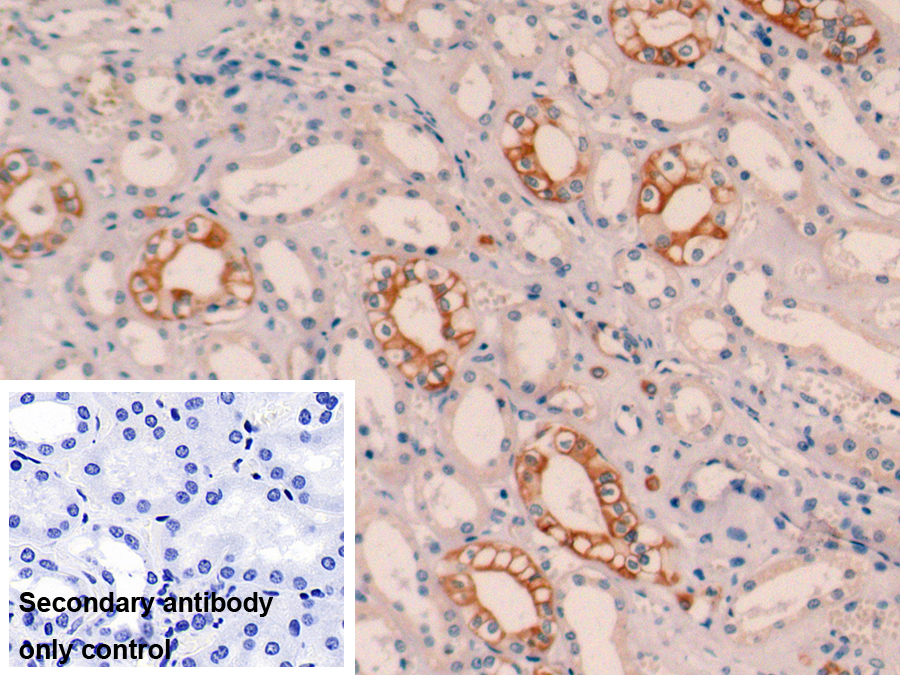Monoclonal Antibody to Cytokeratin 19 (CK19)