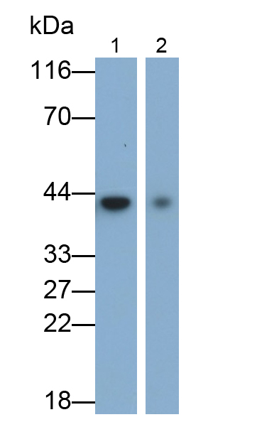 Monoclonal Antibody to Cytokeratin 19 (CK19)