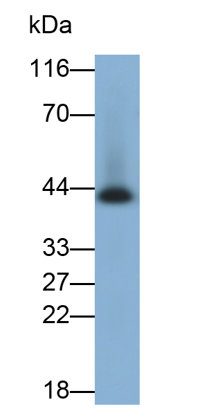 Monoclonal Antibody to Cytokeratin 19 (CK19)