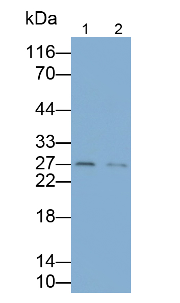 Monoclonal Antibody to Glutamate Decarboxylase 2 (GAD2)