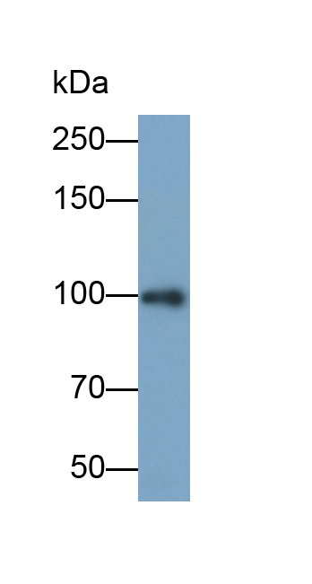 Monoclonal Antibody to Integrin Beta 3 (ITGb3)