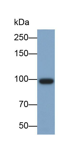 Monoclonal Antibody to Integrin Beta 3 (ITGb3)