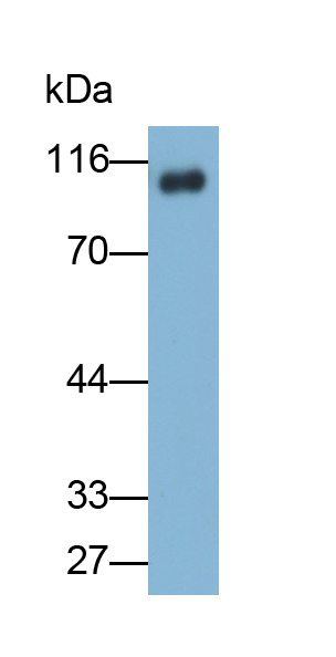 Monoclonal Antibody to Integrin Beta 3 (ITGb3)