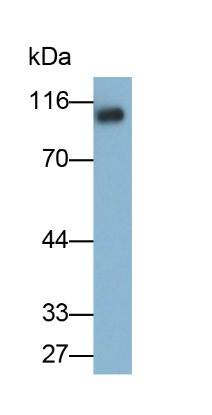 Monoclonal Antibody to Integrin Beta 3 (ITGb3)