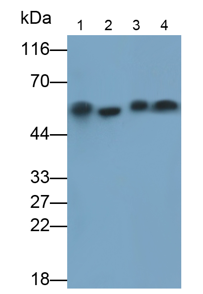 Monoclonal Antibody to Fc Fragment Of IgG Low Affinity IIIb Receptor (FcgR3B)