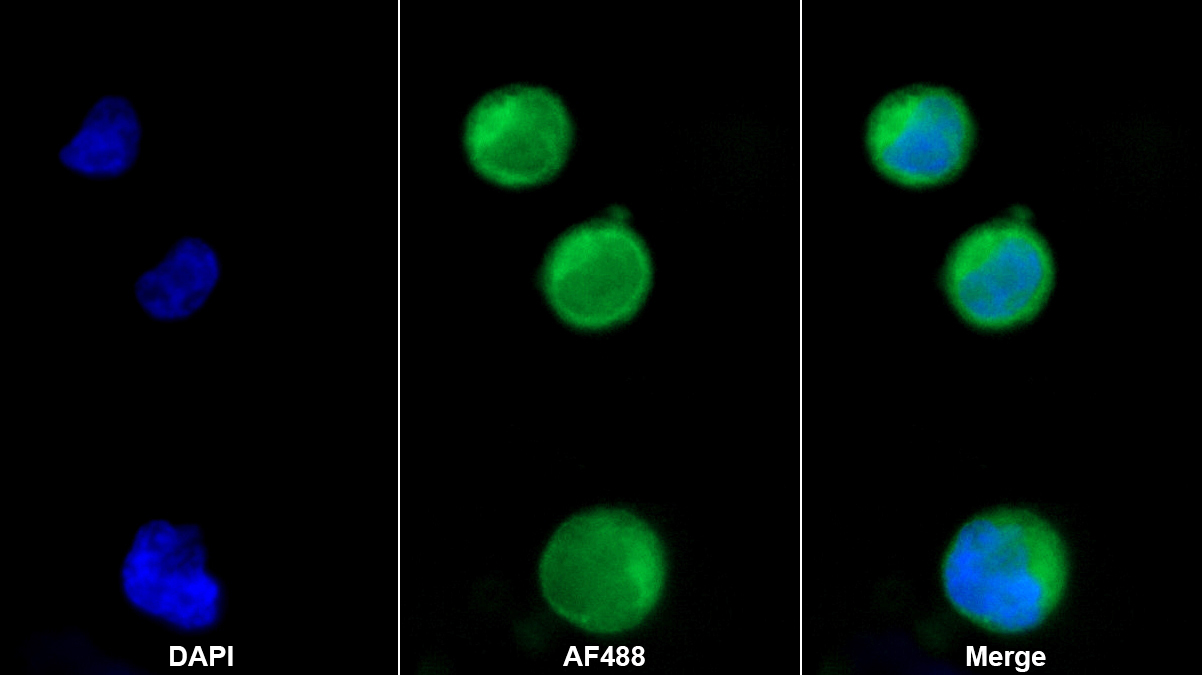 Monoclonal Antibody to Thymic Stromal Lymphopoietin (TSLP)