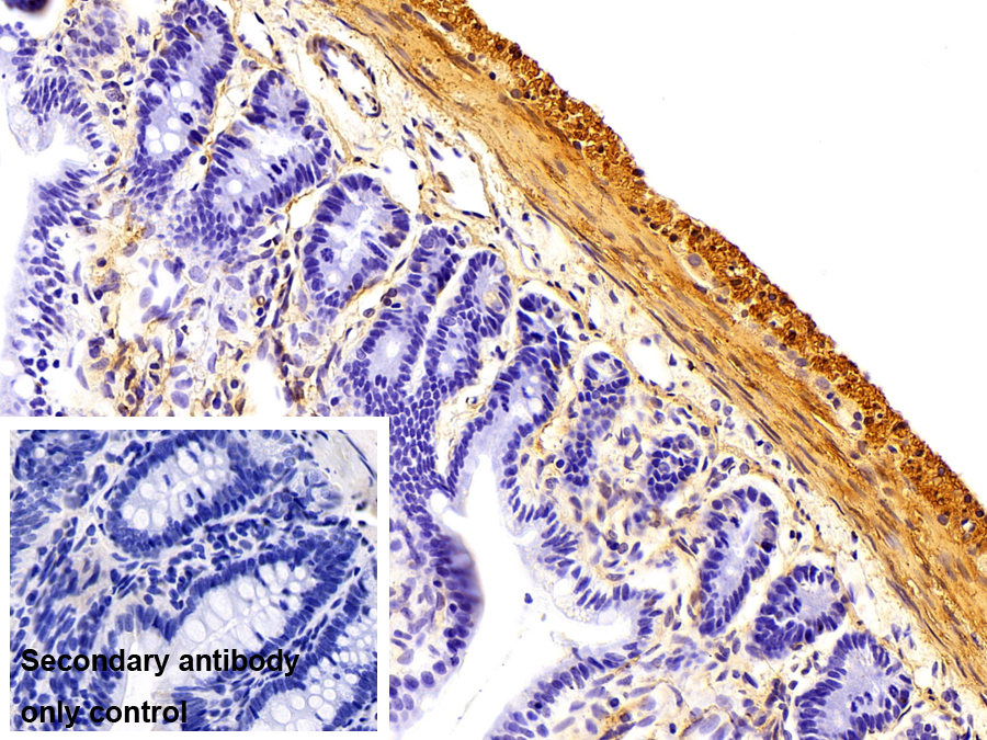 Monoclonal Antibody to Actin Alpha 1, Cardiac Muscle (ACTC1)