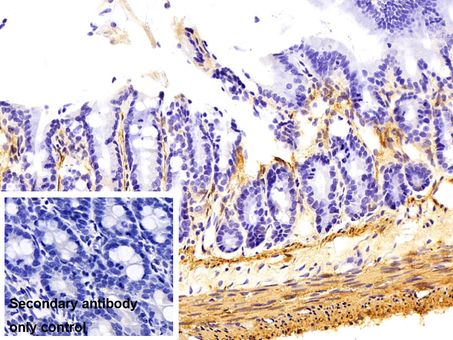 Monoclonal Antibody to Actin Alpha 1, Cardiac Muscle (ACTC1)