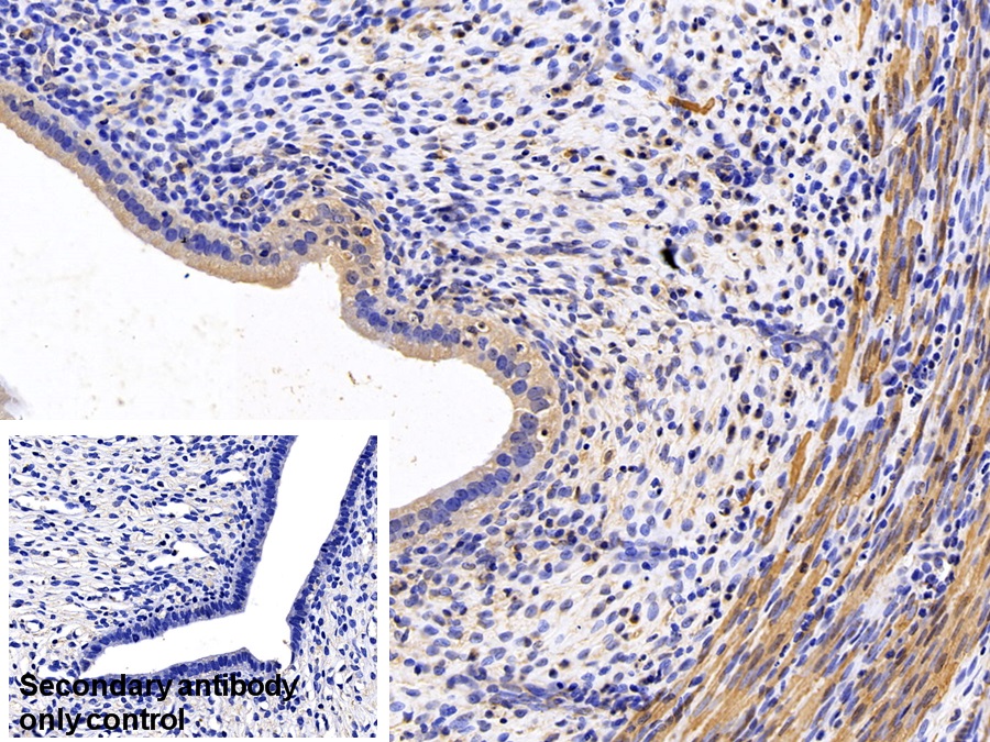 Monoclonal Antibody to Actin Alpha 1, Cardiac Muscle (ACTC1)